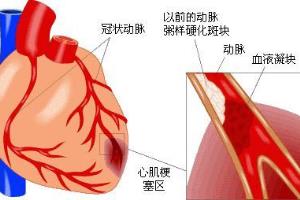 怎样辨别心脏的求救信号.